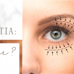 blefaroplastia