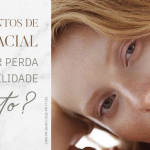 harmonizacao facial curitiba