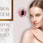 botox curitiba